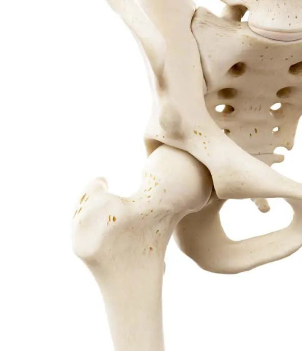 A view of the hip joint from a inferior oblique view